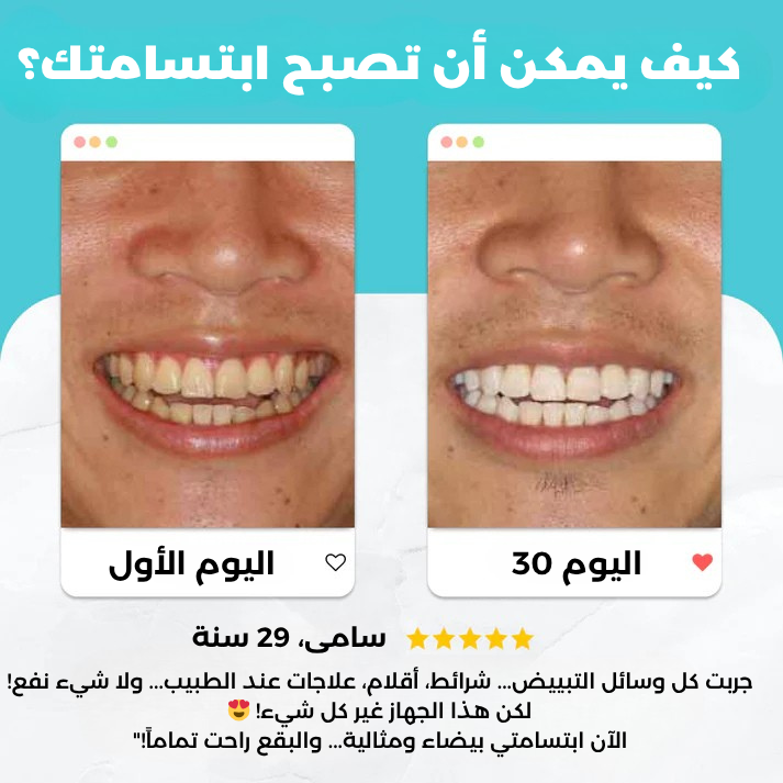 Scandinaviansmiles أول فرشاة أسنان أوتوماتيكية تُنظّف الأسنان بالكامل في 30 ثانية فقط